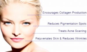 Microneedling Vorteile Hautverjüngung Faltenglättung