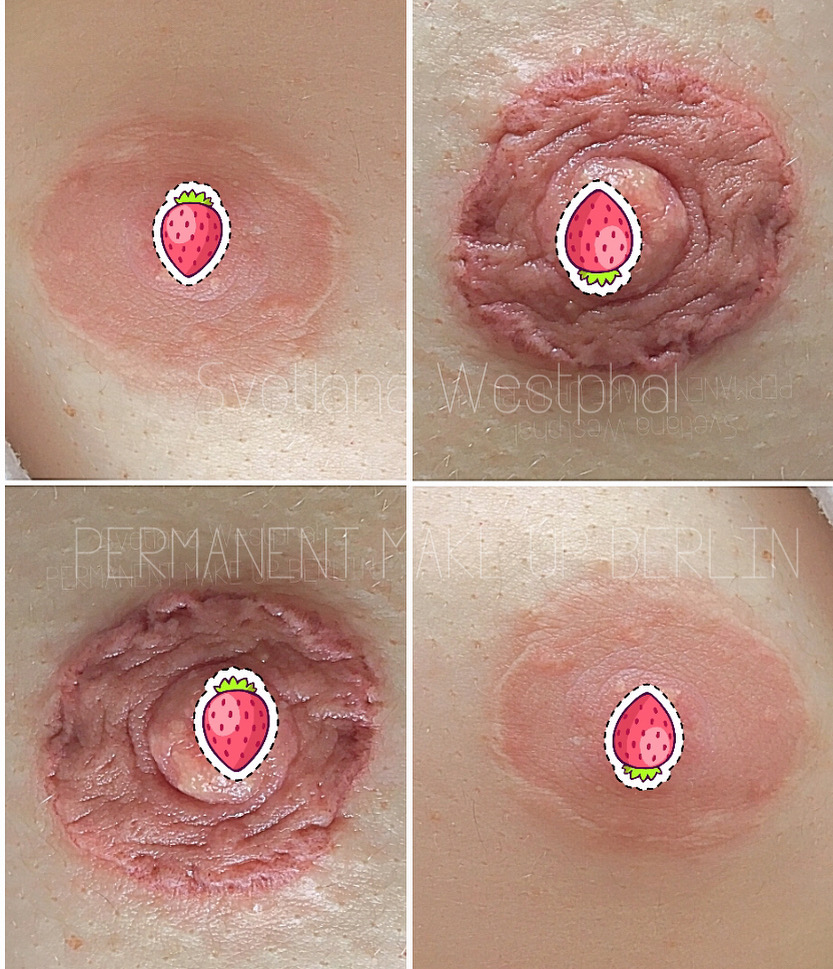 Mamillenrekonstruktion & Areola Narben Pigmentierung Deutschland Berlin⁠